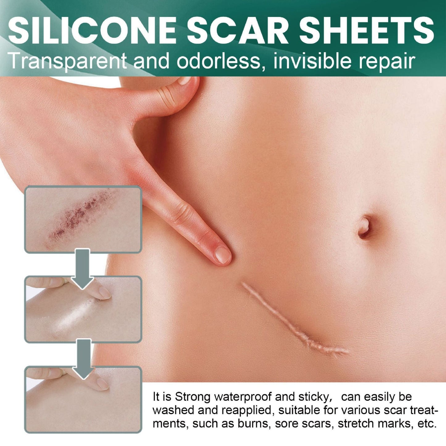 Seurico™-Professional Silicone Scar Sheets king- Scars Removal Treatment-Anti-Aging