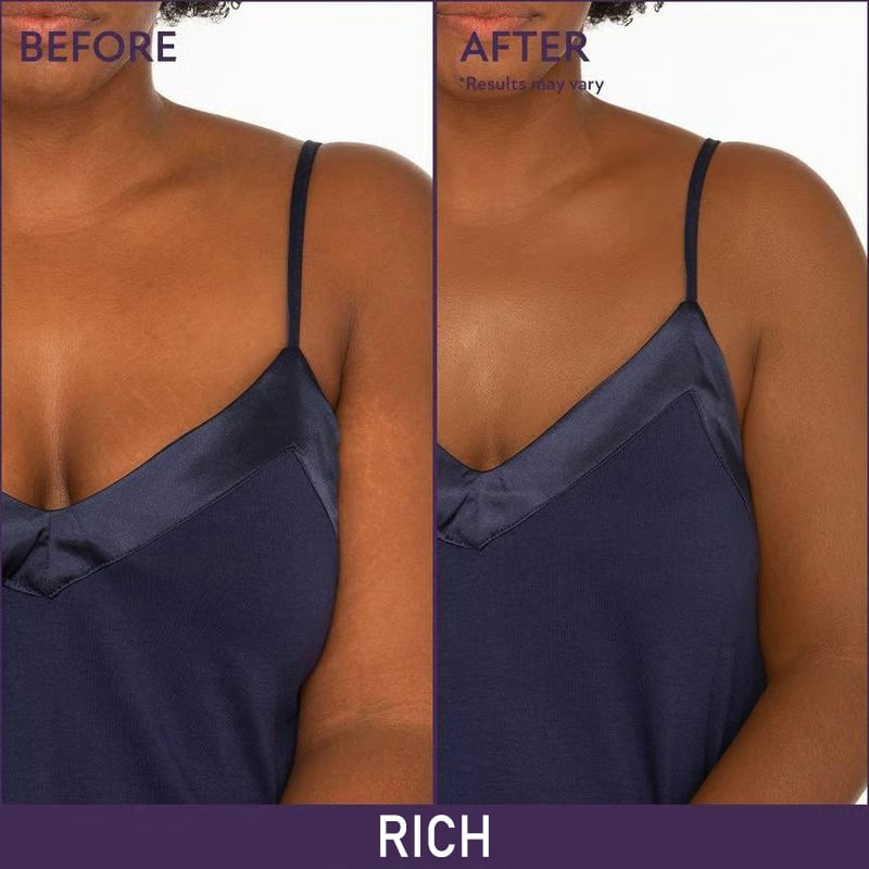 Final 3 Hours: 60%OFF-Soft Matte Cream Concealer with Brush FREE !🎁