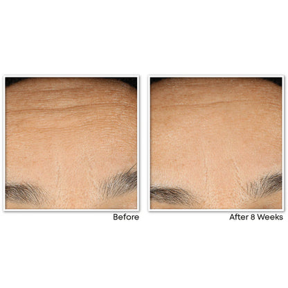 Anti-Aging Night Retinol Capsules Face Serum Treatment