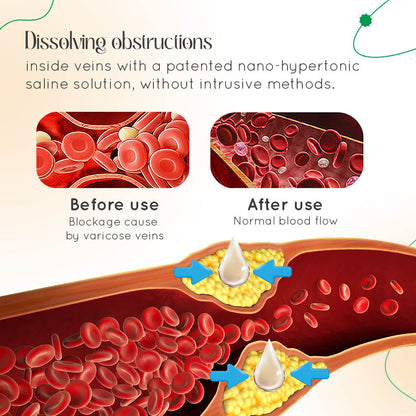 Leg Relief Varicose Veins Cream 50g for Pain and Swelling Body Care Lotions Comfort Skin Care