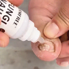 7 Reasons Why This Extra-Strength Nail Treatment Replaces Expensive Prescriptions