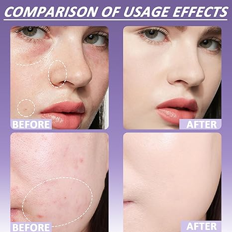 Final 3 Hours: 60%OFF-Soft Matte Cream Concealer with Brush FREE !🎁