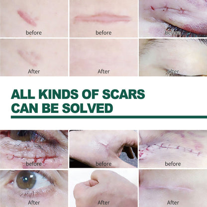 Seurico™-Professional Silicone Scar Sheets king- Scars Removal Treatment-Anti-Aging